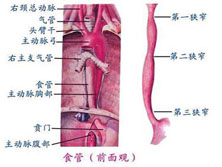 食管管型