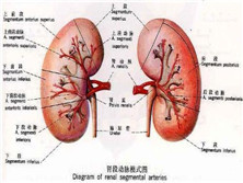 肾血管畸形与压迫