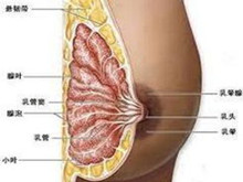 乳房肉瘤