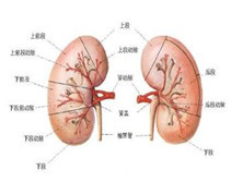 肾周围炎