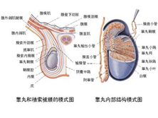 输精管堵塞