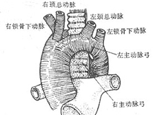 双主动脉弓