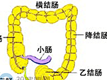 Turcot综合征