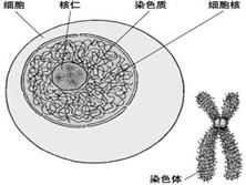 turner综合征