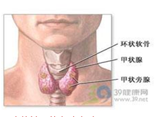 无功能性甲状旁腺囊肿