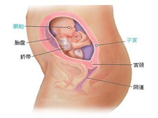 胎儿先天畸形
