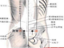 臀上皮神经干痛