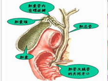 外伤性胆管损伤