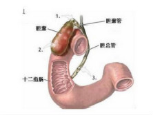 胃急性扩张