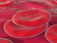 先天性纯红细胞再生障碍性贫血
