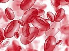 新生儿红细胞增多症-高黏滞度综合征
