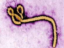 小儿埃博拉病毒病