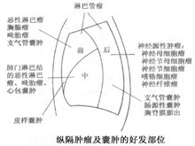 小儿纵隔囊肿及肿瘤