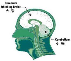 自发性脑室内出血