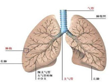 支气管发育不全