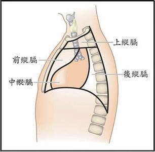 纵隔囊肿及肿瘤