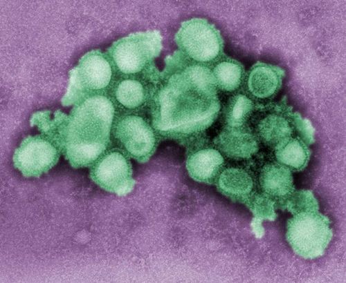 甲型h1n1流感猪流感