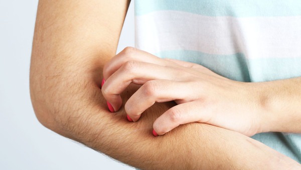 皮肤瘙痒是尿毒症吗 尿毒症早期有哪些症状表现