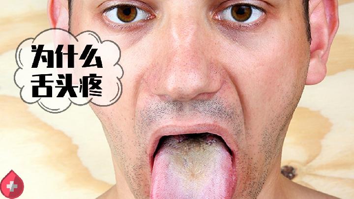 孩子得了地图舌是体虚还是气虚？中医调理有妙法