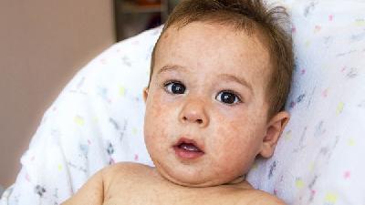 宝宝胀气会有哪些表现 导致宝宝胀气的原因是什么