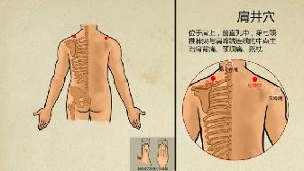 肩膀怎么回事 也许不是肩周炎惹得祸