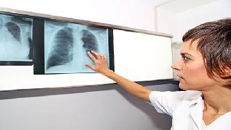晚期肺肿瘤的症状有哪些？