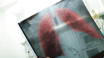 早期的肺肿瘤还能治疗吗？