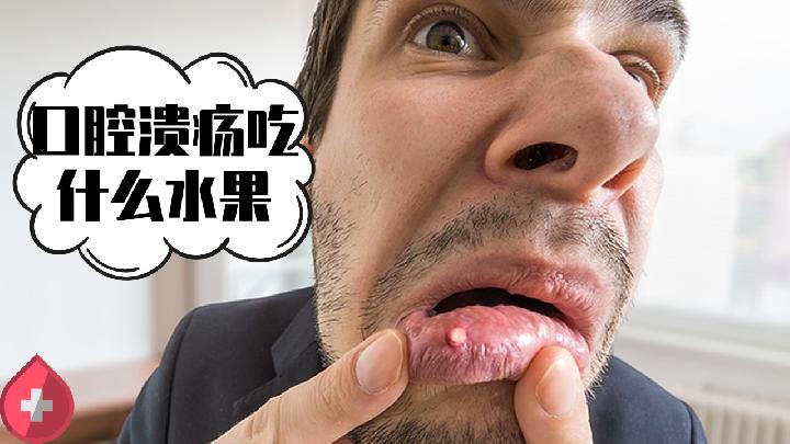 白塞氏病:常見癥狀