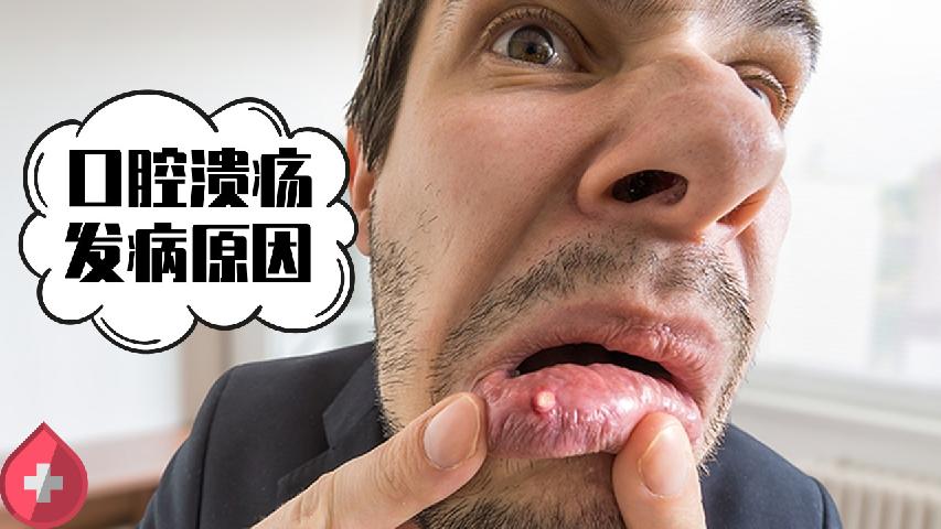 腰椎間盤突出應(yīng)該注意的事項(xiàng)