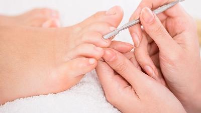 关于灰指甲最常见的十点原因