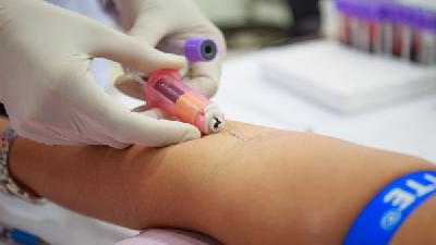 痤疮的症状可以有什么不同表现