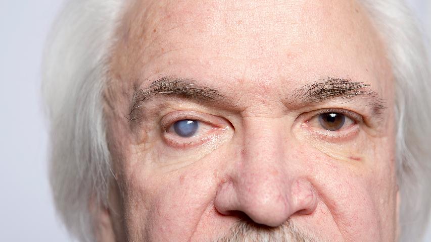 确诊过敏性紫癜要找专业医务人员