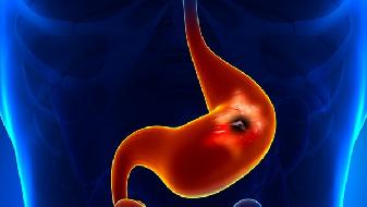 尿痛是得了前列腺炎的预兆的吗 前列腺炎的症状表现
