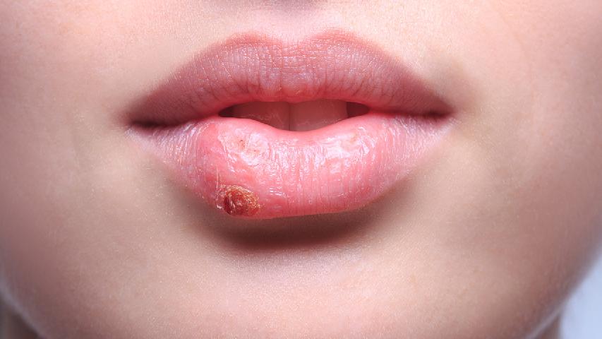 想要遠(yuǎn)離皮肌炎就得知道其病因