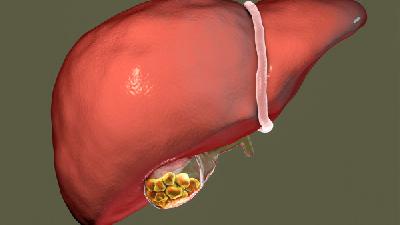 探讨关于鼻咽癌的二大治疗方法