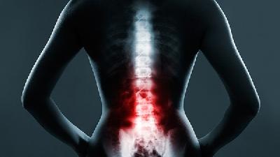 腰椎间盘突出压迫神经的治疗方法