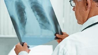 肺纤维化诊断方法