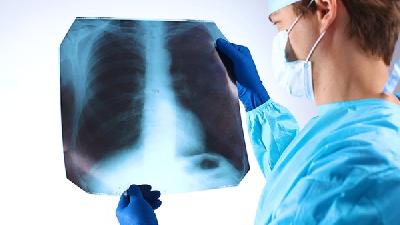 肺气肿对寿命是否有影响呢
