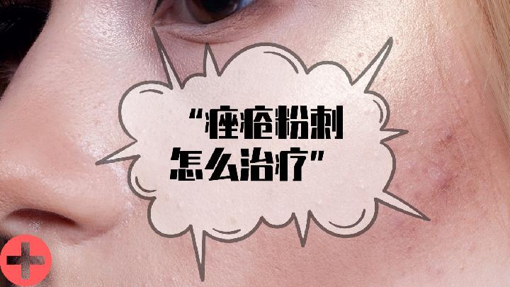 痤瘡初期癥狀表現(xiàn)