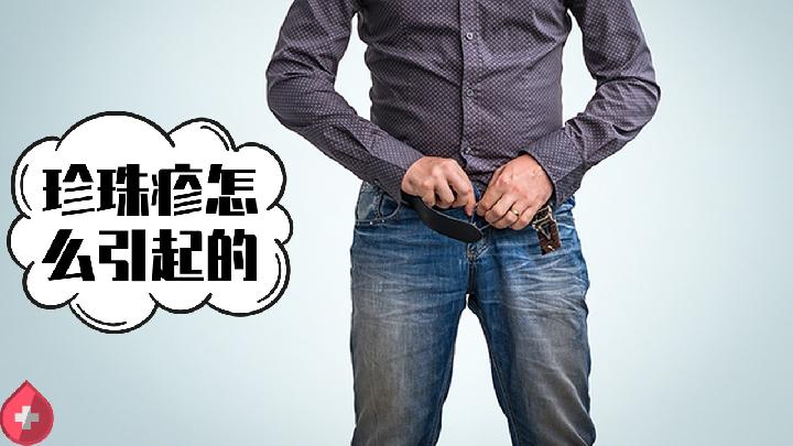 皮肌炎的發(fā)病癥狀是什么樣的