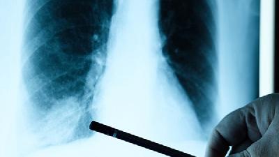 怎样预防慢阻肺的发生