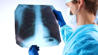 慢阻肺会不会遗传给下一代