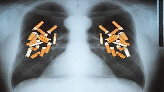 慢阻肺患者要做哪些检查呢
