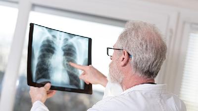 慢阻肺疾病会传染吗