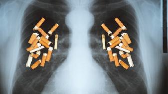 慢阻肺发作的诱因是什么