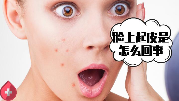 4个洗脸方法可祛痘 去痘印最有效的方法介绍