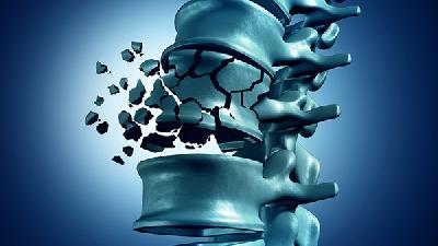 蜂针治疗强直性脊柱炎有效率高