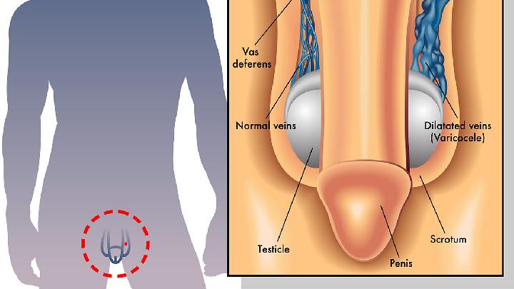 男人睾丸炎有什么症状有哪些呢