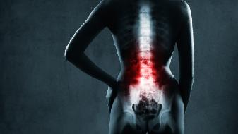 坐骨神经痛的常规检查项目有哪些