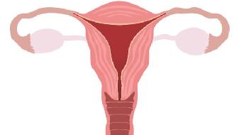 孕期阴道炎反复发作怎么办
